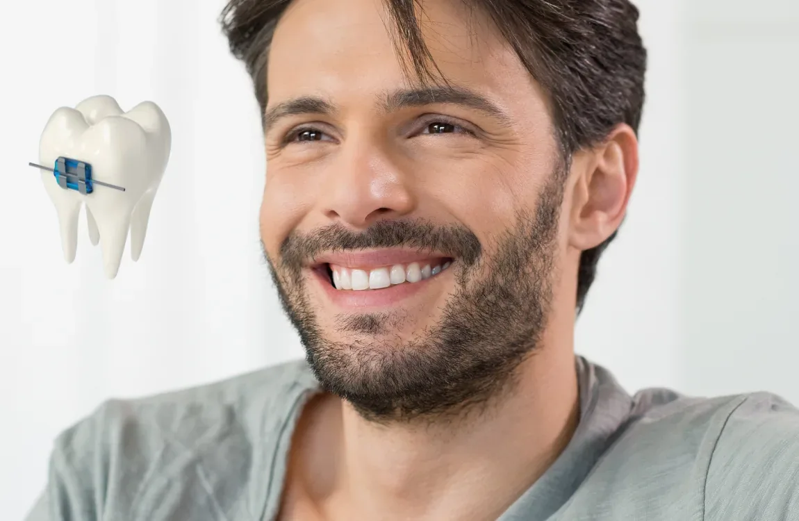 Can Braces Fix an Underbite? - BP Smiles Orthodontics, Queens NY