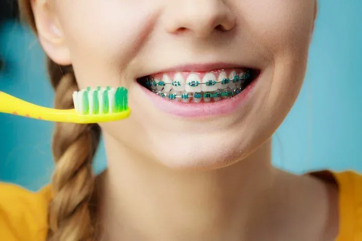 BP Smiles Orthodontics blog article illustration