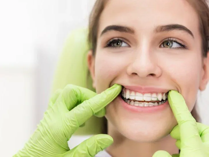 Staying motivated during orthodontic treatment