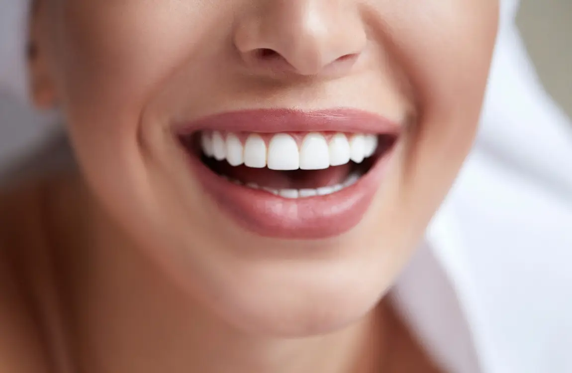 how to prepare for teeth whitening