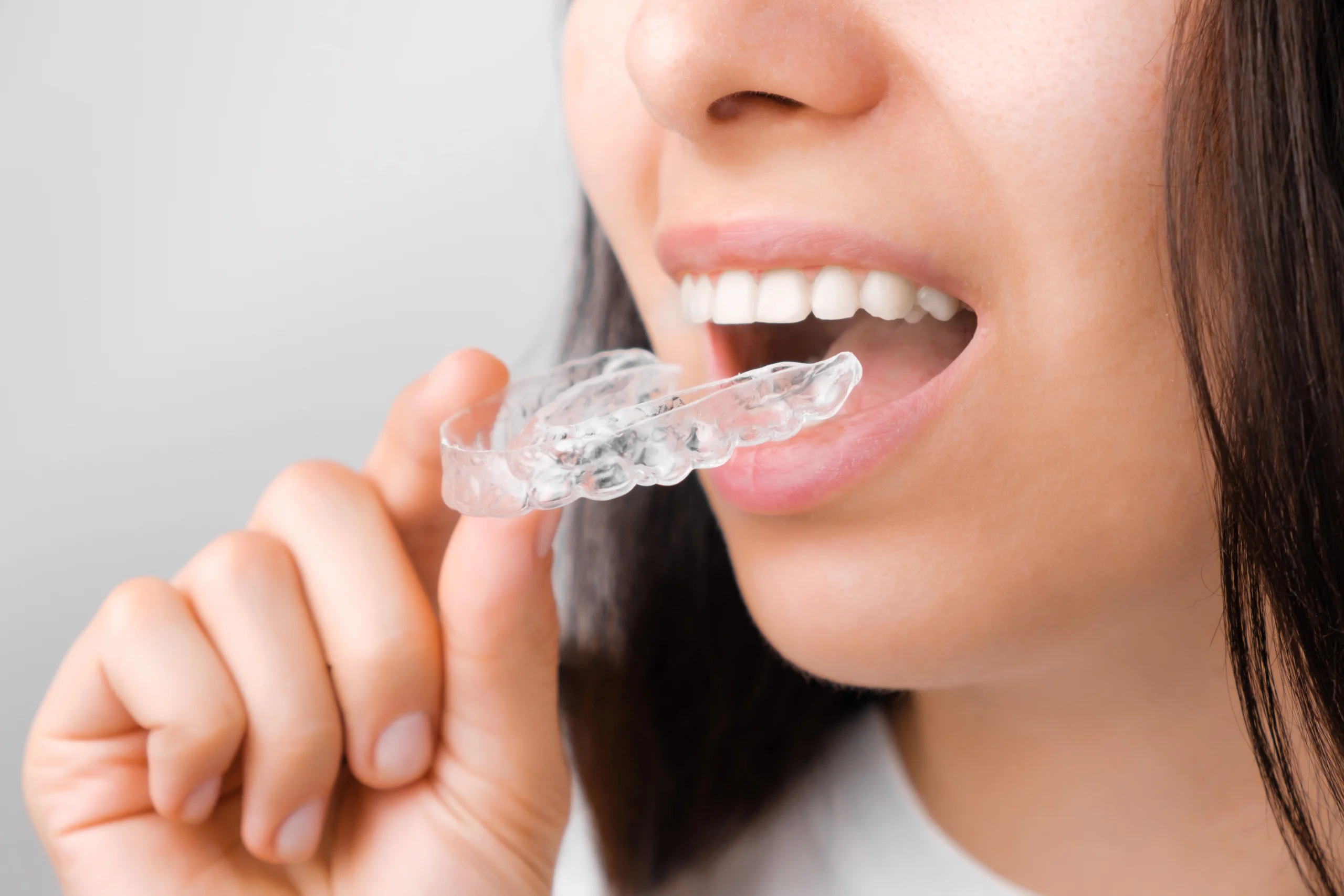how long does it take for invisalign trays to arrive