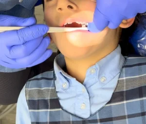 Benefits of Early Orthodontic Care